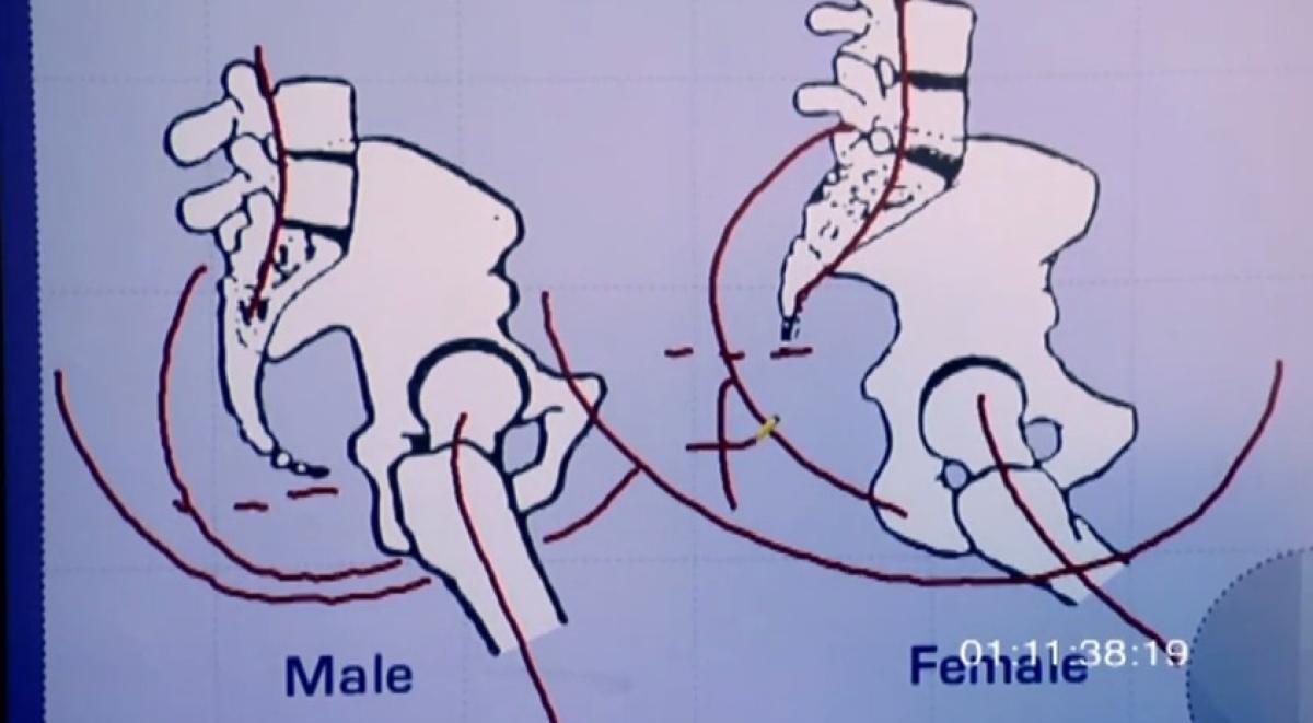 Varför kvinnor lättare hamnar i stolsits